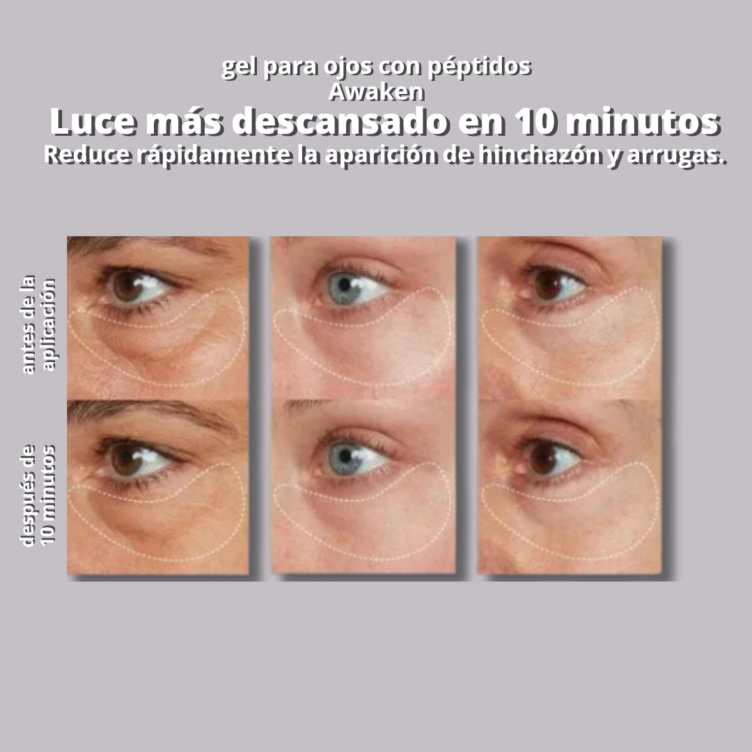 InfiniteLift - Gel tensor rejuvenecedor de ojos